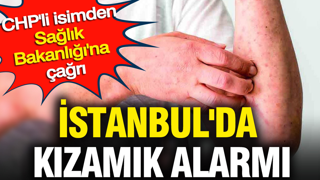 İstanbul’da Kızamık Vakaları Artıyor: CHP’li Vekilden Sağlık Bakanlığı’na Uyarı